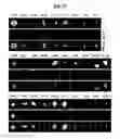 Fig. 41 - Compositions Useful for Treating Herpes Simplex Keratitis, and Methods Using Same