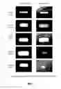 Fig. 05 - Prostamide-containing intraocular implants and methods of use thereof