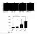 Fig. 06 - TREATMENT OF RESISTANT LESIONS