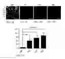 Fig. 07 - TREATMENT OF RESISTANT LESIONS