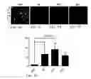 Fig. 14 - TREATMENT OF RESISTANT LESIONS