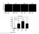 Fig. 15 - TREATMENT OF RESISTANT LESIONS