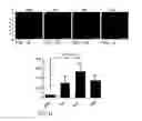 Fig. 20 - TREATMENT OF RESISTANT LESIONS