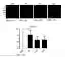 Fig. 21 - TREATMENT OF RESISTANT LESIONS