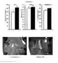 Fig. 15 - Methods for treating metabolic disorders using FGF
