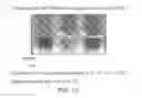 Fig. 14 - High concentration alpha-glucosidase compositions for the treatment of Pompe disease