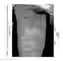 Fig. 02 - Prophylactic normalization of cutaneous wound repair