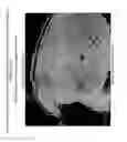 Fig. 08 - Prophylactic normalization of cutaneous wound repair
