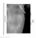 Fig. 10 - Prophylactic normalization of cutaneous wound repair