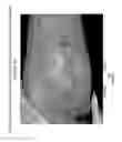 Fig. 11 - Prophylactic normalization of cutaneous wound repair