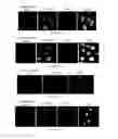 Fig. 14 - Application of ruthenium complexes as nucleic acid vectors of target cell nucleuses