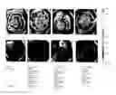 Fig. 30 - COMPOSITIONS FOR GASTROINTESTINAL ADMINISTRATION OF RNA
