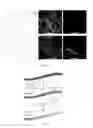 Fig. 09 - Polymer nanofiber scaffolds and uses thereof