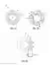 Fig. 15 - Surgical adjuncts having medicants controllably releasable therefrom
