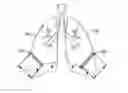 Fig. 01 - Surgical adjuncts and medicants for promoting lung function