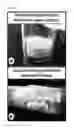 Fig. 02 - Lyophilized polymer scaffold compositions, processes for preparation and use in anabolic wound repair