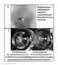 Fig. 04 - Lyophilized polymer scaffold compositions, processes for preparation and use in anabolic wound repair