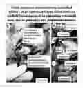Fig. 11 - Lyophilized polymer scaffold compositions, processes for preparation and use in anabolic wound repair