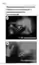 Fig. 14 - Lyophilized polymer scaffold compositions, processes for preparation and use in anabolic wound repair