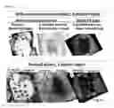 Fig. 27 - Lyophilized polymer scaffold compositions, processes for preparation and use in anabolic wound repair