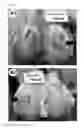 Fig. 29 - Lyophilized polymer scaffold compositions, processes for preparation and use in anabolic wound repair