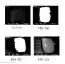 Fig. 05 - Bioerodible magnesium alloy microstructures for endoprostheses