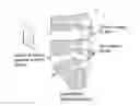 Fig. 01 - Antibiotic drug release sheath
