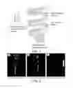 Fig. 02 - Antibiotic drug release sheath