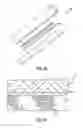 Fig. 23 - Composite adjunct materials for delivering medicants