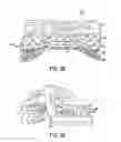 Fig. 24 - Composite adjunct materials for delivering medicants
