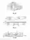 Fig. 25 - Composite adjunct materials for delivering medicants