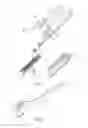Fig. 03 - Adjunct material to provide drug elution from vessels