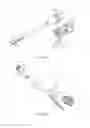 Fig. 04 - Adjunct material to provide drug elution from vessels