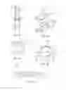 Fig. 11 - Adjunct material to provide drug elution from vessels