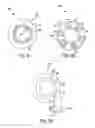 Fig. 15 - Adjunct material to provide controlled drug release