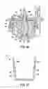 Fig. 19 - Adjunct material to provide controlled drug release