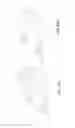 Fig. 111 - Adhesive and peripheral systems and methods for medical devices