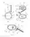 Fig. 02 - Medical fluid-flow regulating devices with blocking unit