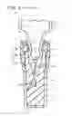 Fig. 09 - Elastic cap and syringe assembly therewith