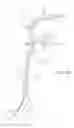 Fig. 14 - Catheter devices and methods for making them