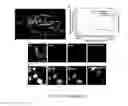 Fig. 18 - Antifouling urinary catheters with shape-memory topographic patterns