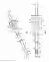 Fig. 03 - Catheter assemblies having a protective lubricious sleeve