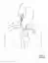 Fig. 02 - Devices for transvascular retrograde access placement