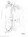 Fig. 07 - Devices for transvascular retrograde access placement