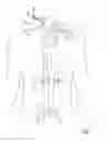 Fig. 08 - Devices for transvascular retrograde access placement