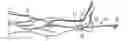 Fig. 01 - Introducer assembly extension and method of use