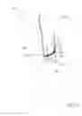 Fig. 15 - Drain tube holder system