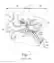 Fig. 02 - Dilation catheter with expandable stop element