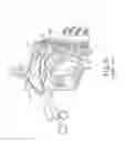 Fig. 06 - Dilation catheter with expandable stop element
