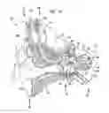 Fig. 02 - Implantable stimulating assembly